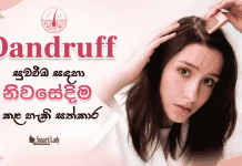 කරදරකාරී හිස්හොරි සඳහා නිවසේදීම කළ හැකි සත්කාර