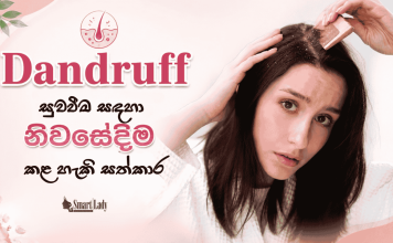 කරදරකාරී හිස්හොරි සඳහා නිවසේදීම කළ හැකි සත්කාර