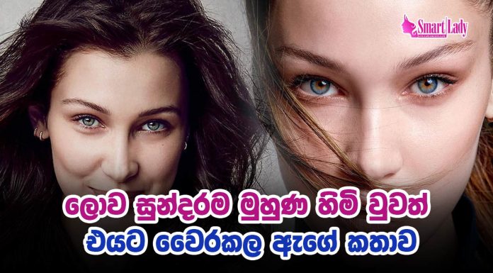 උපතින් ලැබුණු ලොව සුන්දරම මුහුණට වෛරකල ඇගේ කතාව
