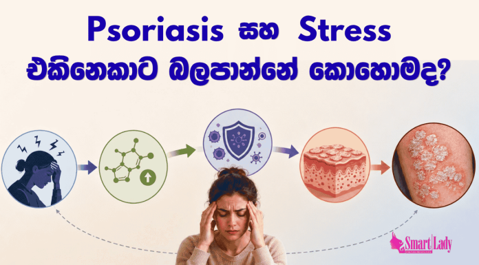 Psoriasis සහ මානසික ආතතිය එකිනෙකාට බලපාන්නේ කොහොමද?