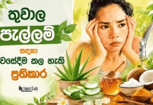 තුවාල පැල්ලම් සඳහා නිවසේදීම කල හැකි ප්රතිකාර
